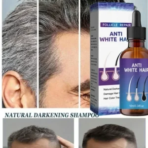 Gray White Hair Treatment Serum Liquid White To Black Natural Color Repair Nourishessence Anti-gray Anti Loss Care Men Women
