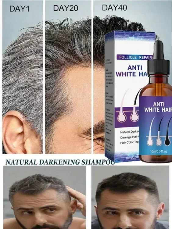 Gray White Hair Treatment Serum Liquid White To Black Natural Color Repair Nourishessence Anti-gray Anti Loss Care Men Women