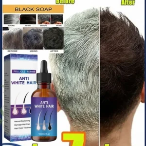 Grey Coverage Bar Shampoo Repair Gray Natural Anti-Grey Hair Essence Serum Smoothing Nourishing Dandruff Natural Darkening Soap